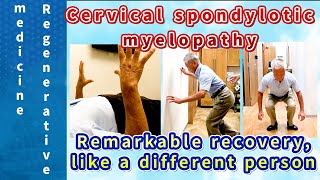 【Regenerative Medicine for Cervical Spondylotic Myelopathy】Amazing Before and After!】