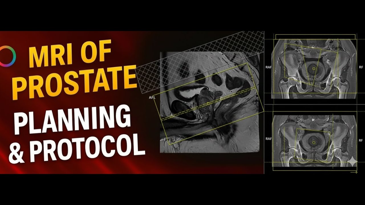 Prostate MRI Planning Tutorial | Siemens 1.5T & 3T Explained