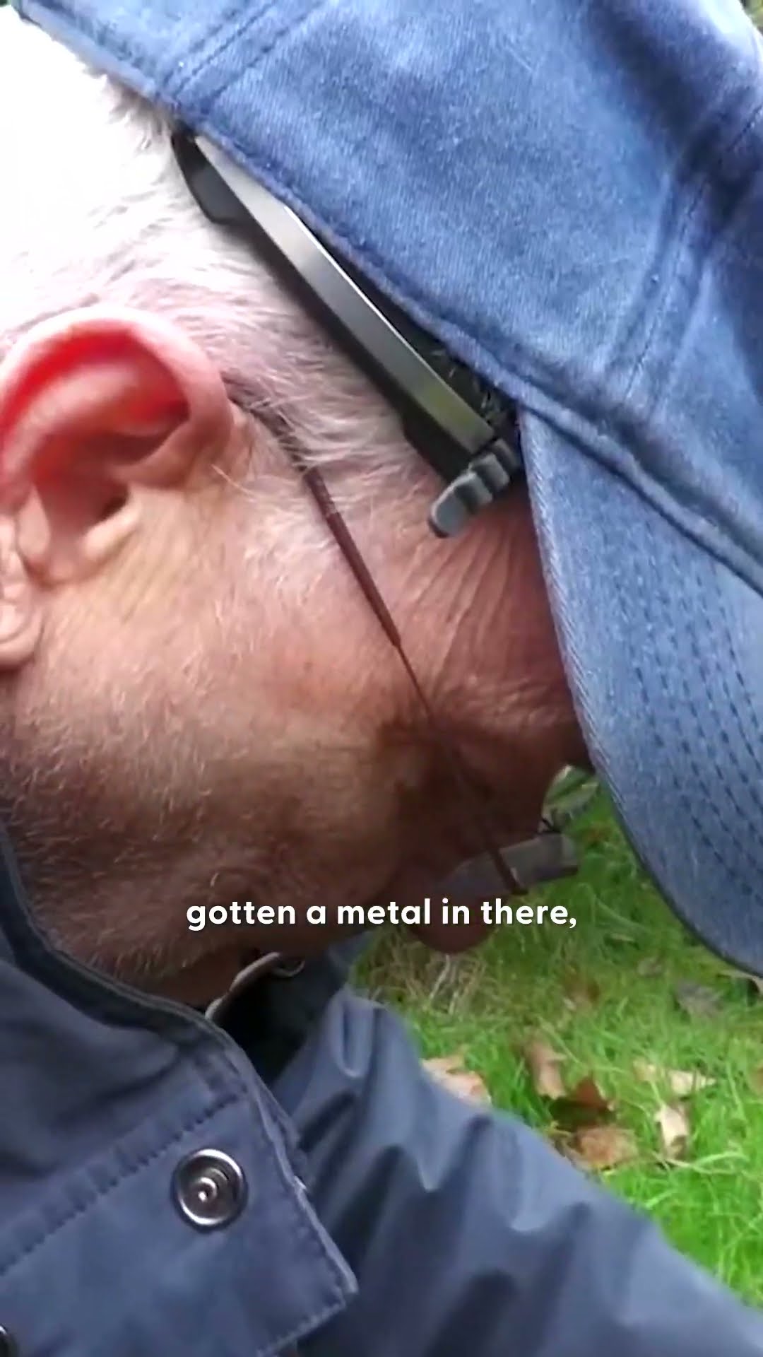 Guy Detangles A Fox From Clothesline | The Dodo