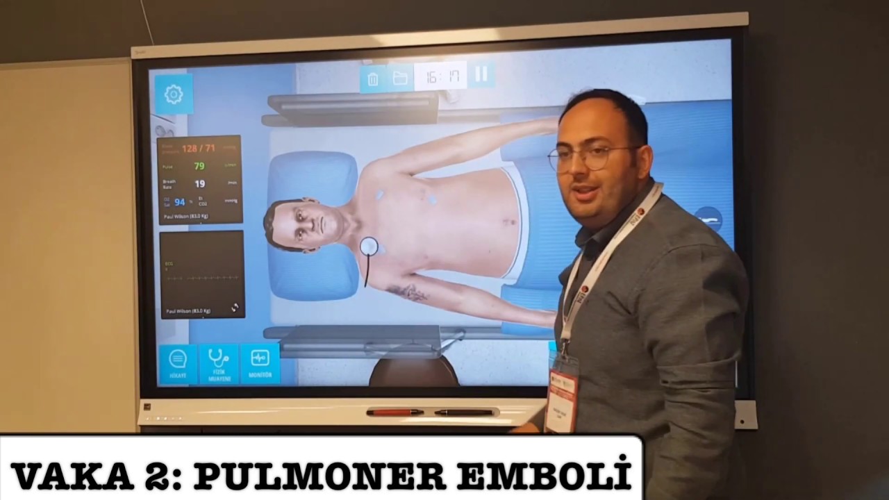 VAKA SİMÜLASYONU: PULMONER EMBOLİ