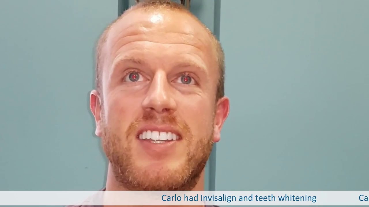 Carlo Invisalign Teeth Whitening Richmond