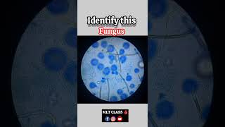 Identify this Fungus🔬🧫 #shorts #microscope #mltclass #fungus #microbiology #trending #dmlt #bmlt#lab