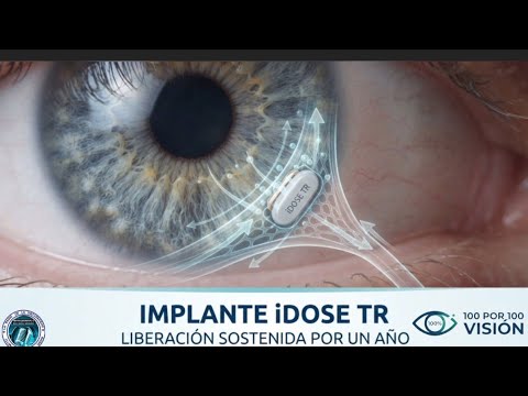 👀 Implante iDose TR: Adiós a las gotas y hola a la libertad en el control del glaucoma. YouTube. 