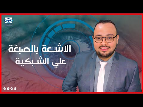 الاشعة بالصبغة على الشبكية أهميتها وبدائلها