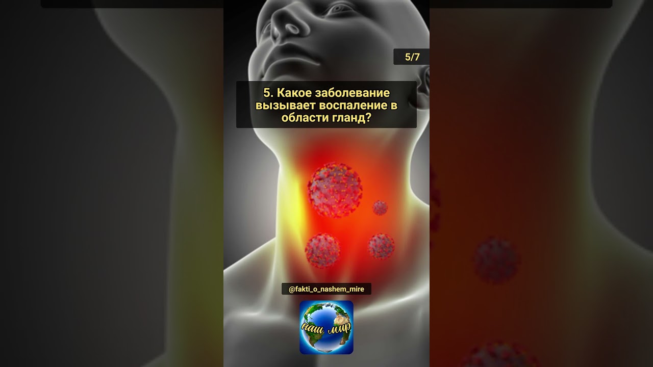 Викторина: Медицина. Часть 1.  #угадай #эрудиция #знания #анатомия #медицина  #факты