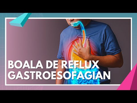 Boala de reflux gastroesofagian | Simptome, Cauze și Tratament | dr. Cristian Costea