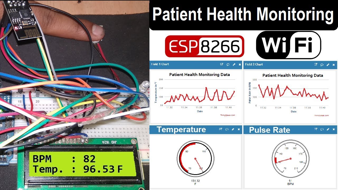 IoT Based Patient Health Monitoring System using ESP8266 & Arduino