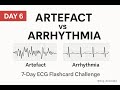 ARRHYTHMIA vs ARTEFACT