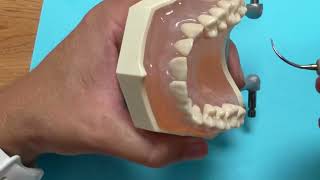 Curved Ultrasonic Tip Selection Vertical Technique