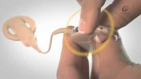 Nucleus® 5 - Locking and unlocking the sound processor advanced