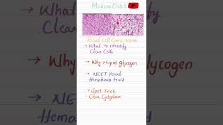 HIGH YIELD DIAGNOSIS OF RCC EXAM FAVOURITE#viral#shortsfeed#shortsviral#shorts#shortsvideo#neet