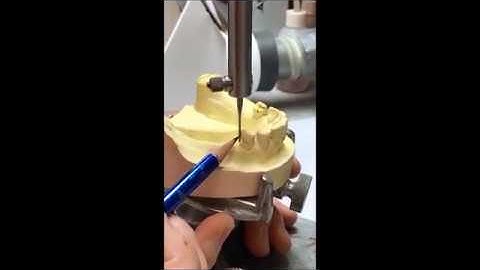 RPD Framework surveying principles -8 min.