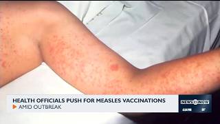 Health officials push for measles vaccinations
Health officials push for measles vaccinations Health officials push for measles vaccinations
