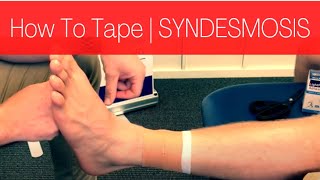 HOW TO TAPE A SYNDESMOSIS HIGH ANKLE SPRAIN