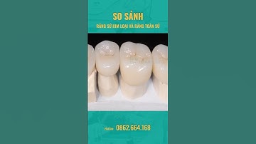So Sánh Răng Sứ Kim Loại Và Răng Toàn Sứ.