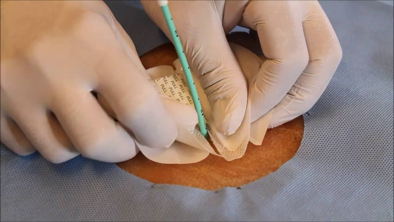 Featured image of post Steps to Make Drain Fix Dressing