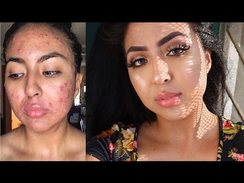 HOW I COVER MY ACNE SCARS || Skin Like Full Coverage