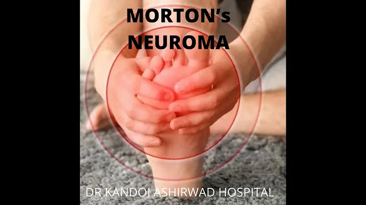 morton' neuroma  explained