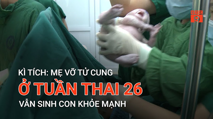 Thai nhi 26 tuần nặng bao nhiêu kg năm 2024