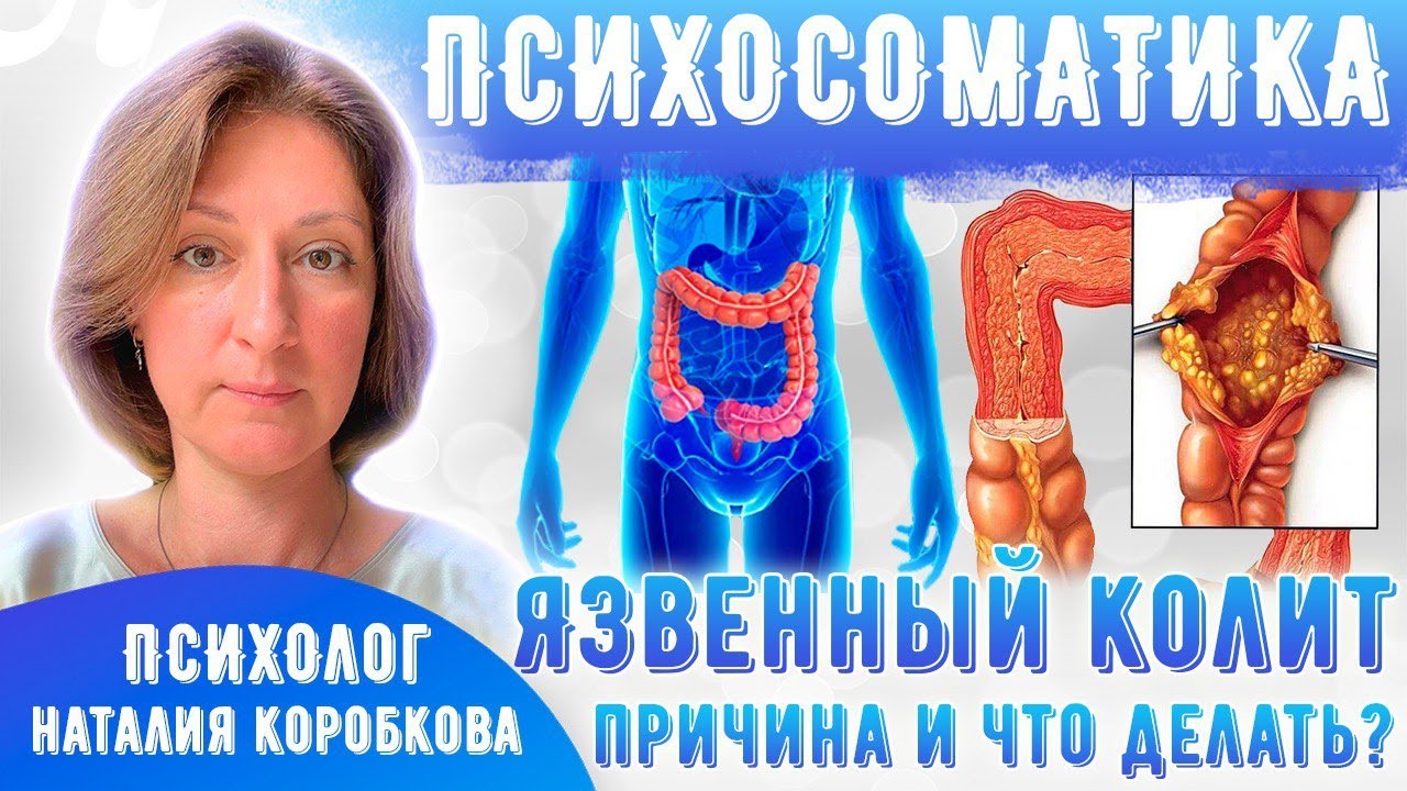 Язвенный колит: причины, чем лечить/Как выйти в ремиссию/Психосоматика ...