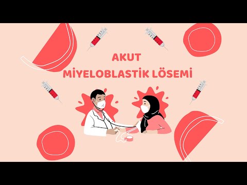 Akut Myeloblastik Lösemi (Örnek Video 2)