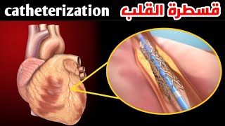 شاهد كيف تتم عملية قسطرة القلب وتركيب الدعامة_cardiac catheterization and stenting
