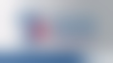 Resection of a Frontal Pole AVM and Clipping of a Frontopolar Feeding Artery Aneurysm