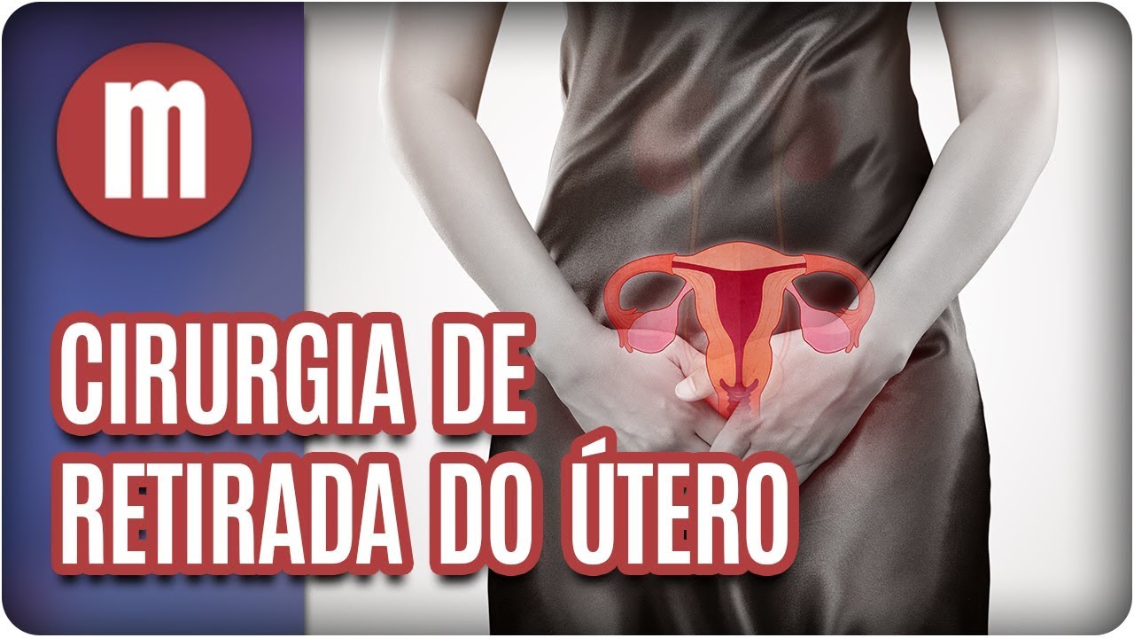 Integra Cirurgia - A remoção de um ou dos dois ovários, chama-se