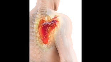 Fix your Shoulder. Scapular Winging Exercises | Life Rx Los Angeles