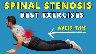 Best Exercises for Spinal Canal Stenosis Pain Relief
