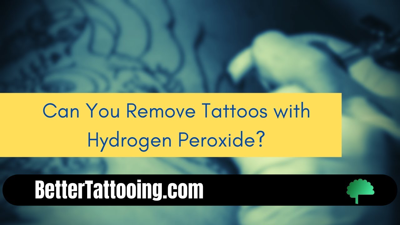 1. Hydrogen Peroxide Tattoo Removal: Before and After Photos - wide 5