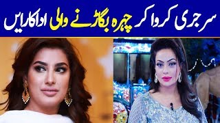 Pakistani Actresses Who Look Horrible After Plastic Surgery  | Before and After Comparison