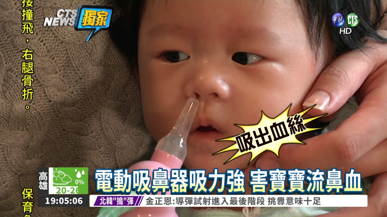 電動吸鼻器嬰兒吸到流鼻血 Youtube