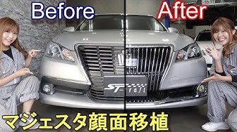 顔面移植 Youtube 顔面移植 Youtube