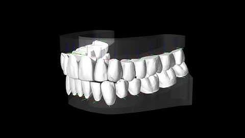 Simulation-based dental articulator with compliant tooth support