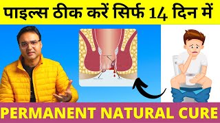 Piles Treatment: पुराने से पुराना पाइल्स (बवासीर) 14  दिन में जड़ से ठीक करें | Piles Home Treatment screenshot 5