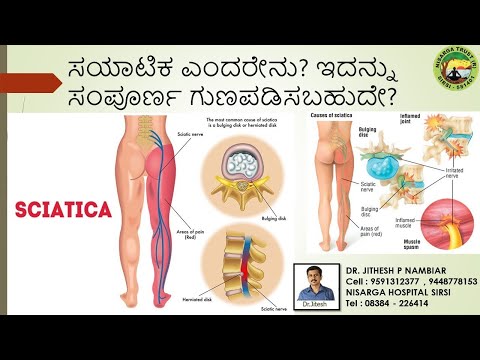 WHAT IS SCIATICA ? PART - II | CAN IT BE COMPLETELY CURED ?  | DR.JITHESH P NAMBIAR