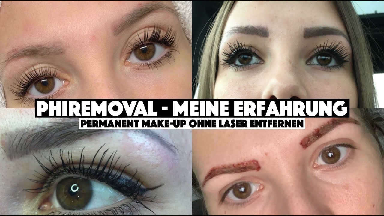 Phiremoval Meine Erfahrung Permanent Make Up Ohne Laser Entfernen Kosten Schmerzen Dauer Youtube