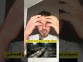 تسريبات مهمة من مشفى تشرين العسكري في سوريا