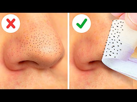 22 EASY WAYS TO REMOVE BLACKHEADS FAST || FACE MASKS, NATURAL BEAUTY HACKS