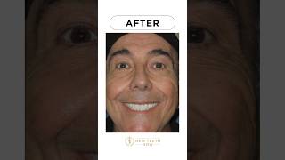 Jimmy’s dental implant smile transformation!