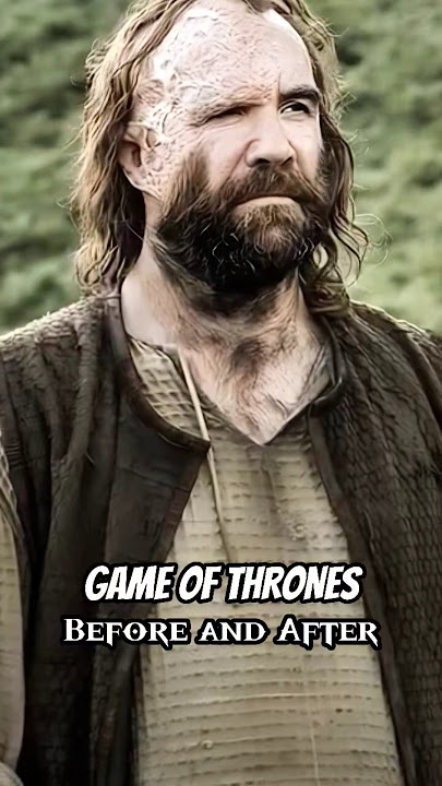 Game Of Thrones Before&After Part 1