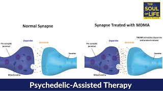 Psychedelic-Assisted Therapy: MDMA