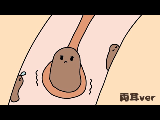 音だけで分かる、耳垢が耳かきにのる瞬間｜ごりごり耳かき 両耳ver｜No Talking ASMR | Ear Cleaning