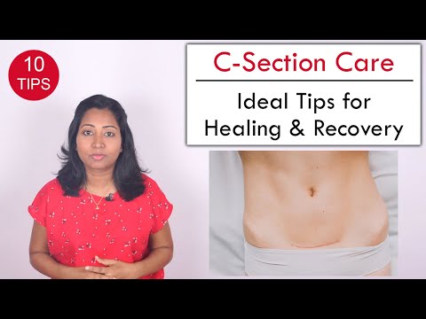 10 Tips to help Heal C Section wound | Post Delivery Care