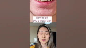 How To Fix Dry And Flaky Skin FaceTory 