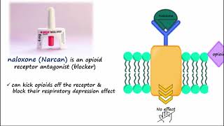 Naloxone (Narcan) - Used to Reverse Opioid Overdose