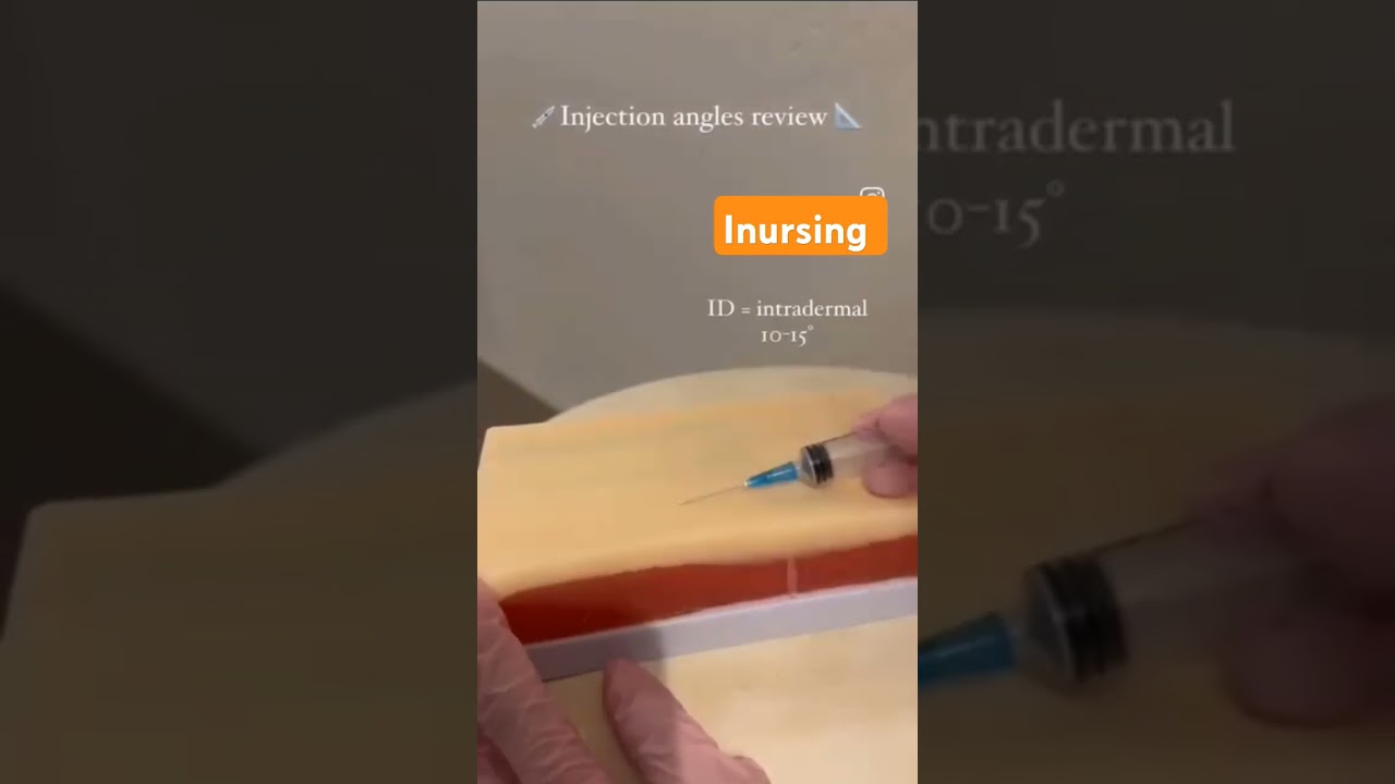 IM Intramuscular injection Push in the Buttocks ketolac & paracetamol & Dexamethasone ventrogluteal