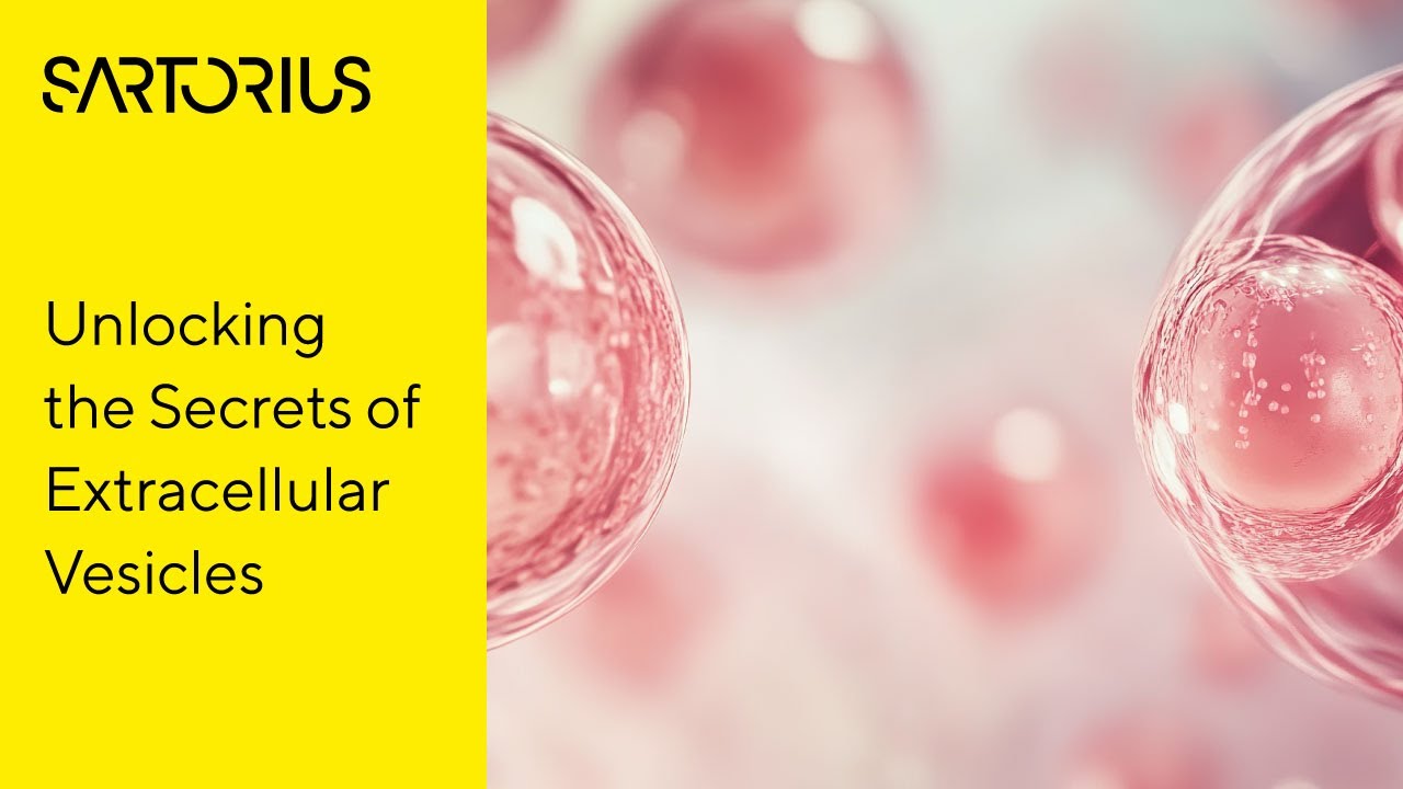 Insights into Extracellular Vesicle Labeling