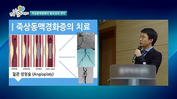 2018건강나눔 공개강좌02회 죽상동맥관리 김병규교수 서울백병원[메디컬TV]